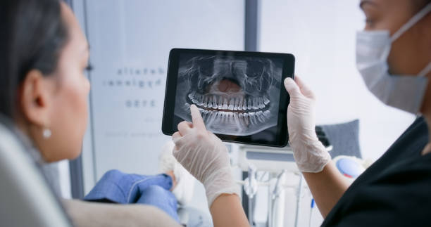 Licensed Wisdom Tooth Removal service in Haywood County County, NC - Smile Center Dentistry
